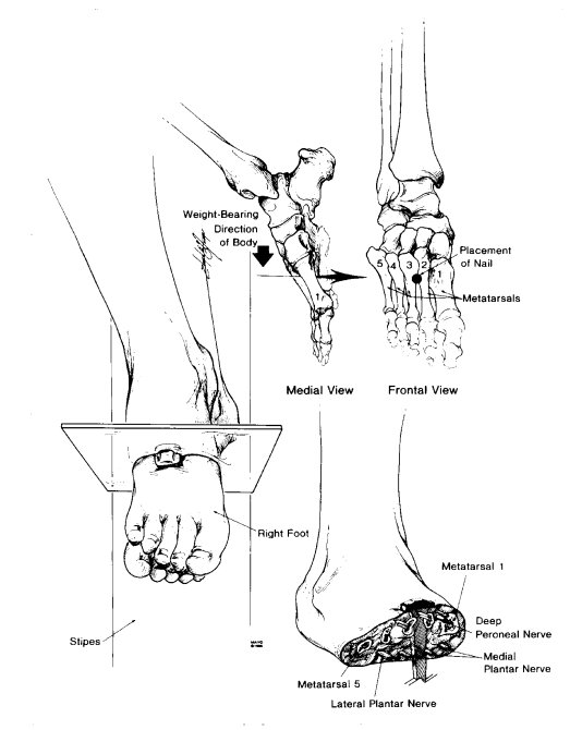 feet1.jpg (47695 bytes)