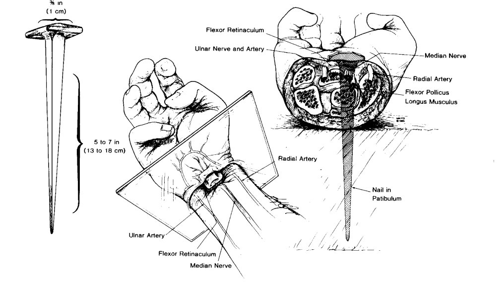 wrists1.jpg (99283 bytes)